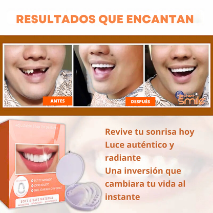 (COMPRA 1 LLEVA 2) Carillas Dentales Snap-On Smile: Tu Sonrisa Perfecta en Segundos, Sin Dentista