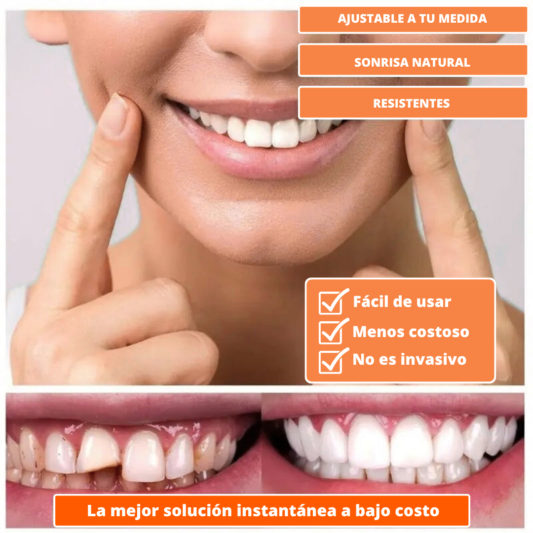 (COMPRA 1 LLEVA 2) Carillas Dentales Snap-On Smile: Tu Sonrisa Perfecta en Segundos, Sin Dentista
