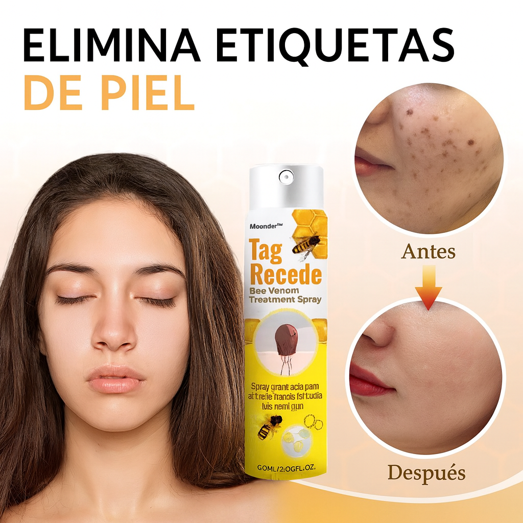 ÚLTIMAS 24 UNIDADES Tag Recede – Eliminador Natural de Verrugas, Lunares y Manchas de la Piel